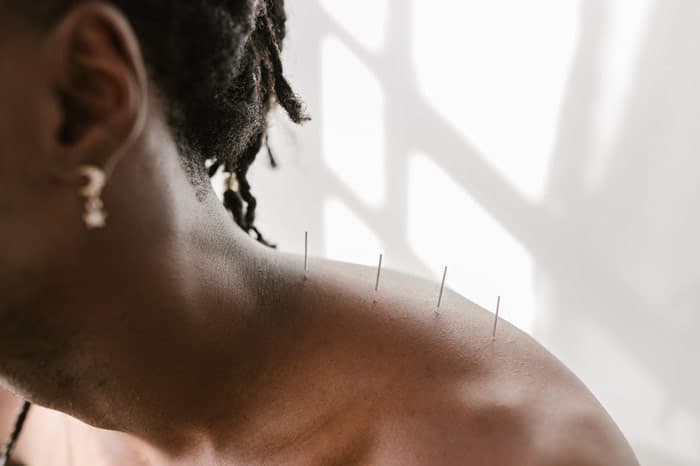 Acupuncture pour arrêter de fumer